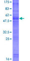 GPM6B Protein - 12.5% SDS-PAGE of human GPM6B stained with Coomassie Blue