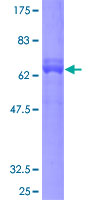 GPN1 / XAB1 Protein - 12.5% SDS-PAGE of human XAB1 stained with Coomassie Blue