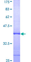 GPN1 / XAB1 Protein - 12.5% SDS-PAGE Stained with Coomassie Blue.
