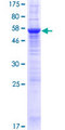 GPN2 Protein - 12.5% SDS-PAGE of human ATPBD1B stained with Coomassie Blue