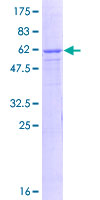 GPN3 Protein - 12.5% SDS-PAGE of human ATPBD1C stained with Coomassie Blue