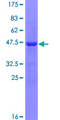 Gpnat1 / GNPNAT1 Protein - 12.5% SDS-PAGE of human GNPNAT1 stained with Coomassie Blue