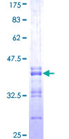 Gpnat1 / GNPNAT1 Protein - 12.5% SDS-PAGE Stained with Coomassie Blue.