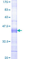 GPNMB / Osteoactivin Protein - 12.5% SDS-PAGE Stained with Coomassie Blue.