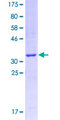 GPR119 Protein - 12.5% SDS-PAGE Stained with Coomassie Blue.