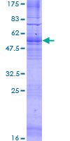 GPR12 Protein - 12.5% SDS-PAGE of human GPR12 stained with Coomassie Blue