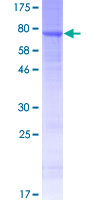 GPR142 Protein - 12.5% SDS-PAGE of human GPR142 stained with Coomassie Blue