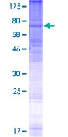 GPR143 Protein - 12.5% SDS-PAGE of human GPR143 stained with Coomassie Blue