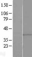 GPR146 Protein - Western validation with an anti-DDK antibody * L: Control HEK293 lysate R: Over-expression lysate