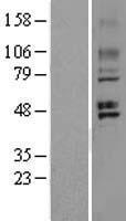 GPR150 Protein - Western validation with an anti-DDK antibody * L: Control HEK293 lysate R: Over-expression lysate