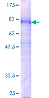 GPR151 Protein - 12.5% SDS-PAGE of human GPR151 stained with Coomassie Blue