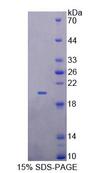 GPR151 Protein - Recombinant Galanin Receptor 4 (GALR4) by SDS-PAGE