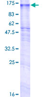 GPR155 Protein - 12.5% SDS-PAGE of human GPR155 stained with Coomassie Blue