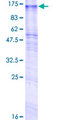 GPR155 Protein - 12.5% SDS-PAGE of human GPR155 stained with Coomassie Blue