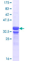 GPR158 Protein - 12.5% SDS-PAGE Stained with Coomassie Blue.