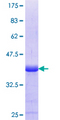 GPR161 Protein - 12.5% SDS-PAGE Stained with Coomassie Blue.