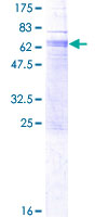 GPR162 Protein - 12.5% SDS-PAGE of human GPR162 stained with Coomassie Blue