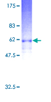GPR17 Protein - 12.5% SDS-PAGE of human GPR17 stained with Coomassie Blue