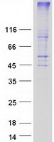 GPR171 Protein - Purified recombinant protein GPR171 was analyzed by SDS-PAGE gel and Coomassie Blue Staining
