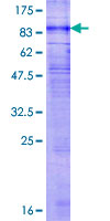GPR176 Protein - 12.5% SDS-PAGE of human GPR176 stained with Coomassie Blue