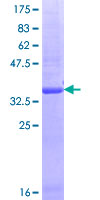 GPR180 Protein - 12.5% SDS-PAGE Stained with Coomassie Blue.