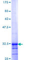 GPR182 / ADMR Protein - 12.5% SDS-PAGE Stained with Coomassie Blue.
