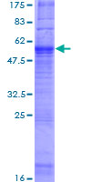 GPR21 Protein - 12.5% SDS-PAGE of human GPR21 stained with Coomassie Blue