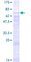 GPR34 Protein - 12.5% SDS-PAGE of human GPR34 stained with Coomassie Blue