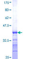 GPR37L1 Protein - 12.5% SDS-PAGE Stained with Coomassie Blue.
