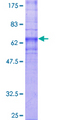 GPR4 Protein - 12.5% SDS-PAGE of human GPR4 stained with Coomassie Blue