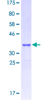 GPR4 Protein - 12.5% SDS-PAGE Stained with Coomassie Blue.