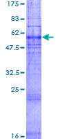 GPR45 Protein - 12.5% SDS-PAGE of human GPR45 stained with Coomassie Blue