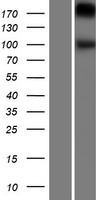GPR48 / LGR4 Protein - Western validation with an anti-DDK antibody * L: Control HEK293 lysate R: Over-expression lysate