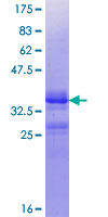 GPR48 / LGR4 Protein - 12.5% SDS-PAGE Stained with Coomassie Blue.