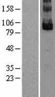 GPR49 / LGR5 Protein - Western validation with an anti-DDK antibody * L: Control HEK293 lysate R: Over-expression lysate