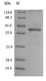 GPR49 / LGR5 Protein - (Tris-Glycine gel) Discontinuous SDS-PAGE (reduced) with 5% enrichment gel and 15% separation gel.