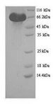 GPR49 / LGR5 Protein - (Tris-Glycine gel) Discontinuous SDS-PAGE (reduced) with 5% enrichment gel and 15% separation gel.