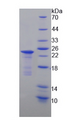 GPR49 / LGR5 Protein - Recombinant Leucine Rich Repeat Containing G Protein Coupled Receptor 5 (LGR5) by SDS-PAGE