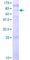 GPR50 Protein - 12.5% SDS-PAGE of human GPR50 stained with Coomassie Blue