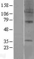 GPR6 Protein - Western validation with an anti-DDK antibody * L: Control HEK293 lysate R: Over-expression lysate
