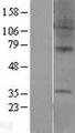 GPR6 Protein - Western validation with an anti-DDK antibody * L: Control HEK293 lysate R: Over-expression lysate