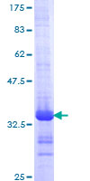 GPR62 Protein - 12.5% SDS-PAGE Stained with Coomassie Blue.