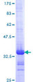 GPR62 Protein - 12.5% SDS-PAGE Stained with Coomassie Blue.