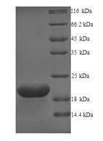 GPR75 Protein - (Tris-Glycine gel) Discontinuous SDS-PAGE (reduced) with 5% enrichment gel and 15% separation gel.