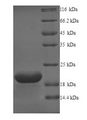 GPR75 Protein - (Tris-Glycine gel) Discontinuous SDS-PAGE (reduced) with 5% enrichment gel and 15% separation gel.