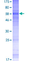 GPRC5A / RAI3 Protein - 12.5% SDS-PAGE of human GPRC5A stained with Coomassie Blue