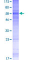 GPRC5A / RAI3 Protein - 12.5% SDS-PAGE of human GPRC5A stained with Coomassie Blue