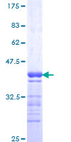 GPRC5C Protein - 12.5% SDS-PAGE Stained with Coomassie Blue.