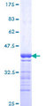 GPRC5C Protein - 12.5% SDS-PAGE Stained with Coomassie Blue.