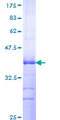 GPRC5D Protein - 12.5% SDS-PAGE Stained with Coomassie Blue.